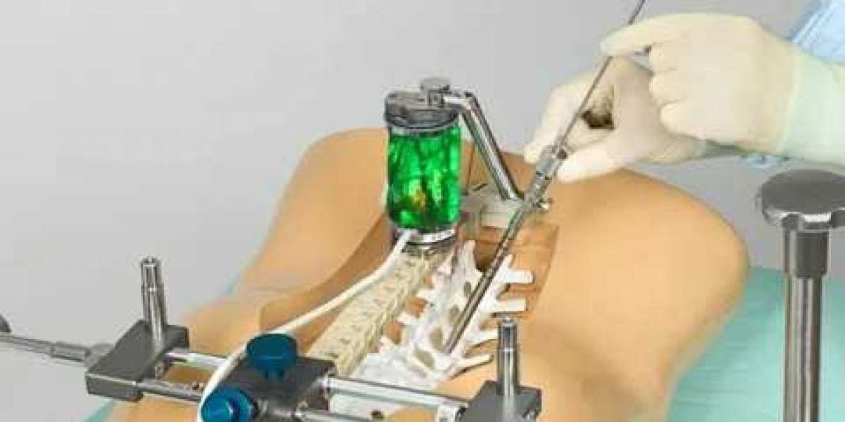 Spine Surgery Market is anticipated to expand at a CAGR of 3.8% from 2022 to 2028
