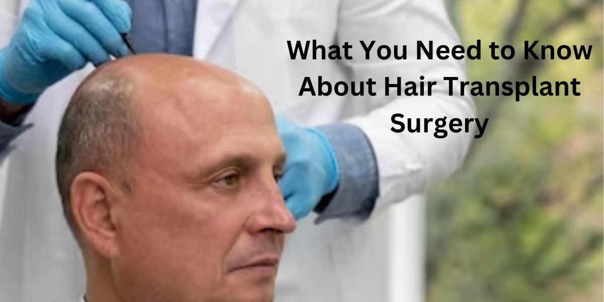 What You Need to Know About Hair Transplant Surgery